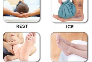 Rest, Ice, Compression, Elevate