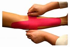 tennis elbow splinting