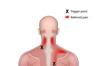 referred pain